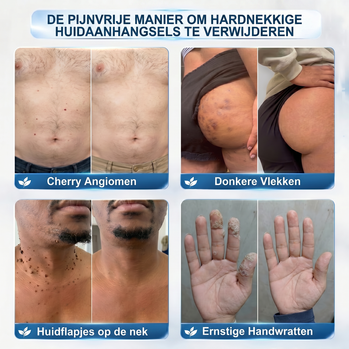 𝐎𝐟𝐟𝐢𝐜𝐢ë𝐥𝐞 𝐦𝐞𝐫𝐤𝐬𝐡𝐨𝐩 📣 𝐏𝐢𝐜𝐝𝐨®𝟕-𝐃𝐀𝐆𝐄𝐍 𝐖𝐫𝐚𝐭𝐭𝐞𝐧 & 𝐏𝐥𝐞𝐤𝐣𝐞𝐬 𝐕𝐞𝐫𝐰𝐢𝐣𝐝𝐞𝐫𝐚𝐚𝐫(Pijnloze rollerball die geen sporen achterlaat)