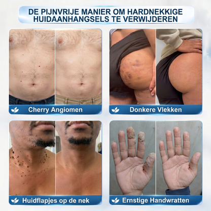 𝐎𝐟𝐟𝐢𝐜𝐢ë𝐥𝐞 𝐦𝐞𝐫𝐤𝐬𝐡𝐨𝐩 📣 𝐏𝐢𝐜𝐝𝐨®𝟕-𝐃𝐀𝐆𝐄𝐍 𝐖𝐫𝐚𝐭𝐭𝐞𝐧 & 𝐏𝐥𝐞𝐤𝐣𝐞𝐬 𝐕𝐞𝐫𝐰𝐢𝐣𝐝𝐞𝐫𝐚𝐚𝐫(Pijnloze rollerball die geen sporen achterlaat)