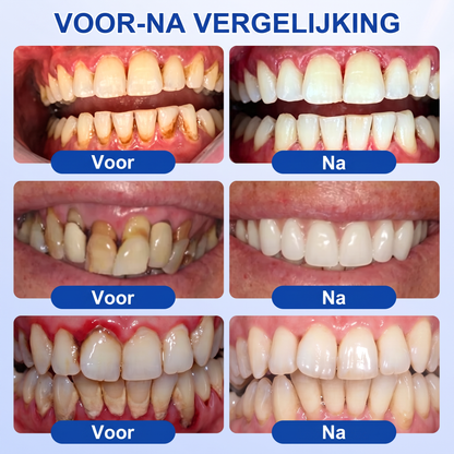 🏅🧸𝐺𝑙𝑖𝑚𝘮𝘦𝘳𝘭𝘺® 🦷 GUMREVIVE PERIODONTAAL REPARATIEGEL