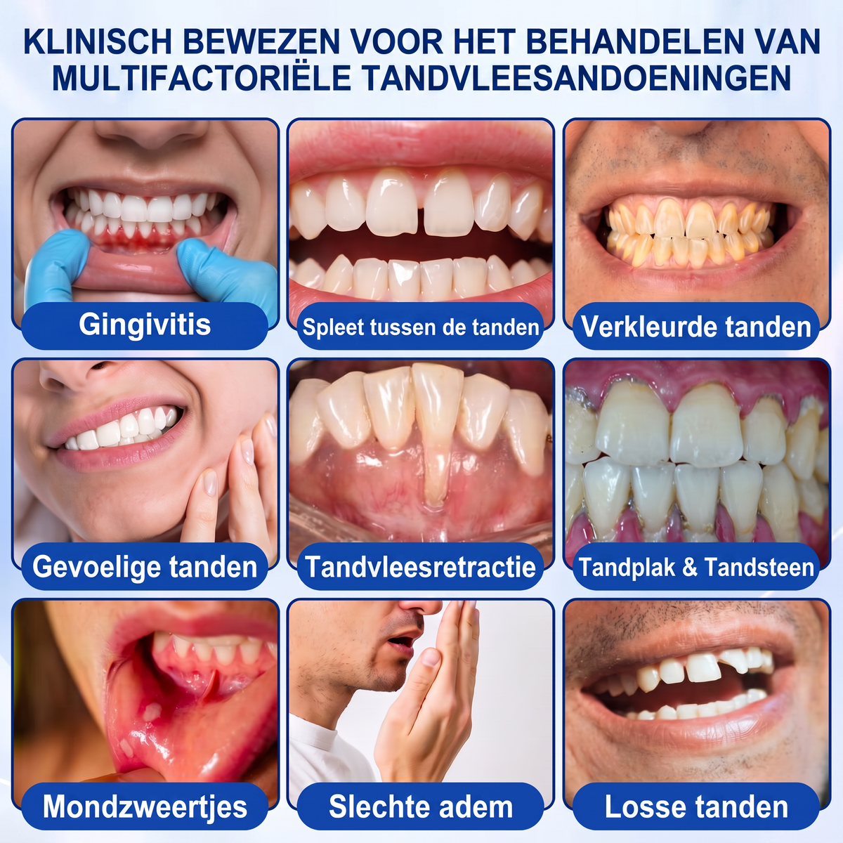 🏅🧸𝐺𝑙𝑖𝑚𝘮𝘦𝘳𝘭𝘺® 🦷 GUMREVIVE PERIODONTAAL REPARATIEGEL