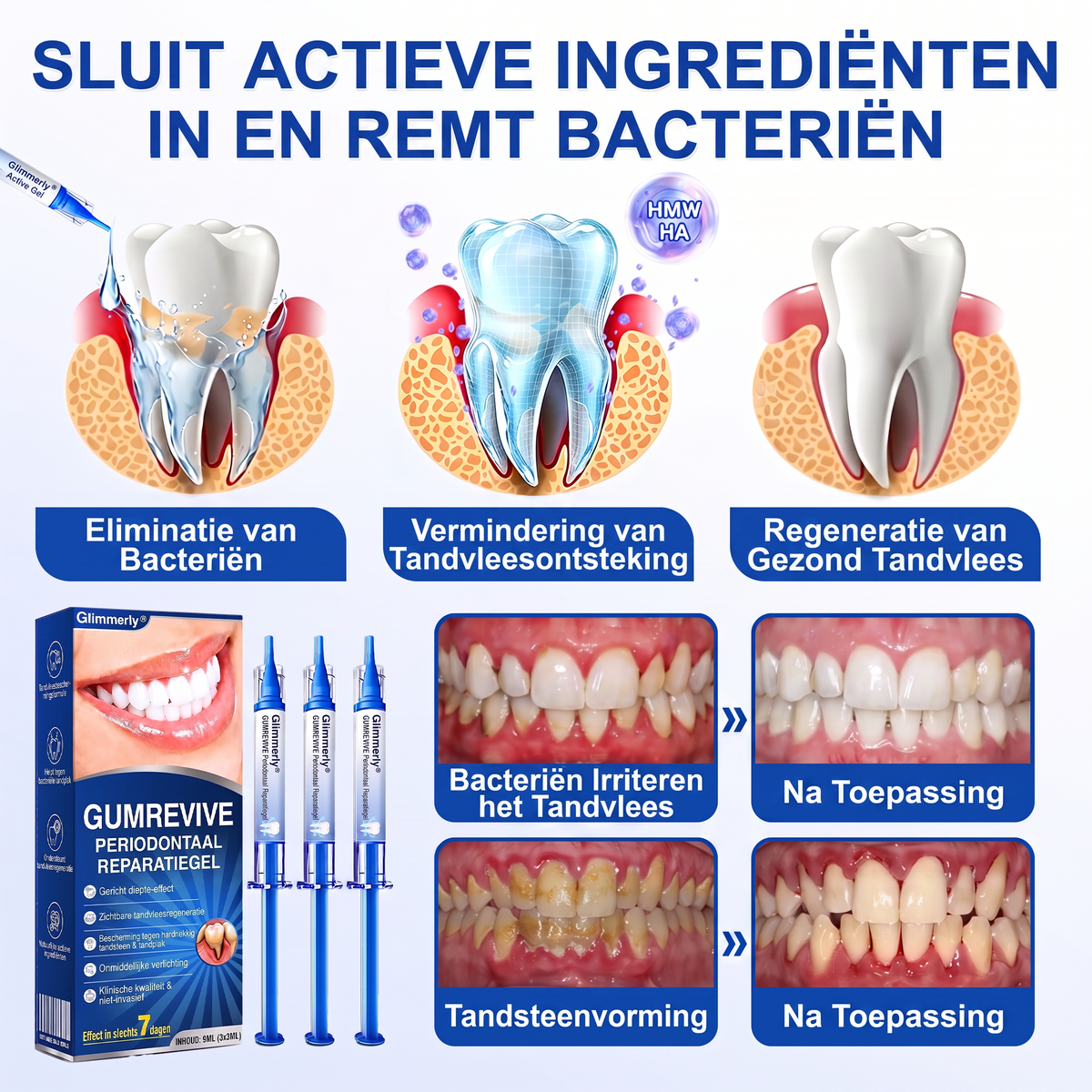 🏅🧸𝐺𝑙𝑖𝑚𝘮𝘦𝘳𝘭𝘺® 🦷 GUMREVIVE PERIODONTAAL REPARATIEGEL