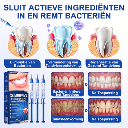 🏅🧸𝐺𝑙𝑖𝑚𝘮𝘦𝘳𝘭𝘺® 🦷 GUMREVIVE PERIODONTAAL REPARATIEGEL