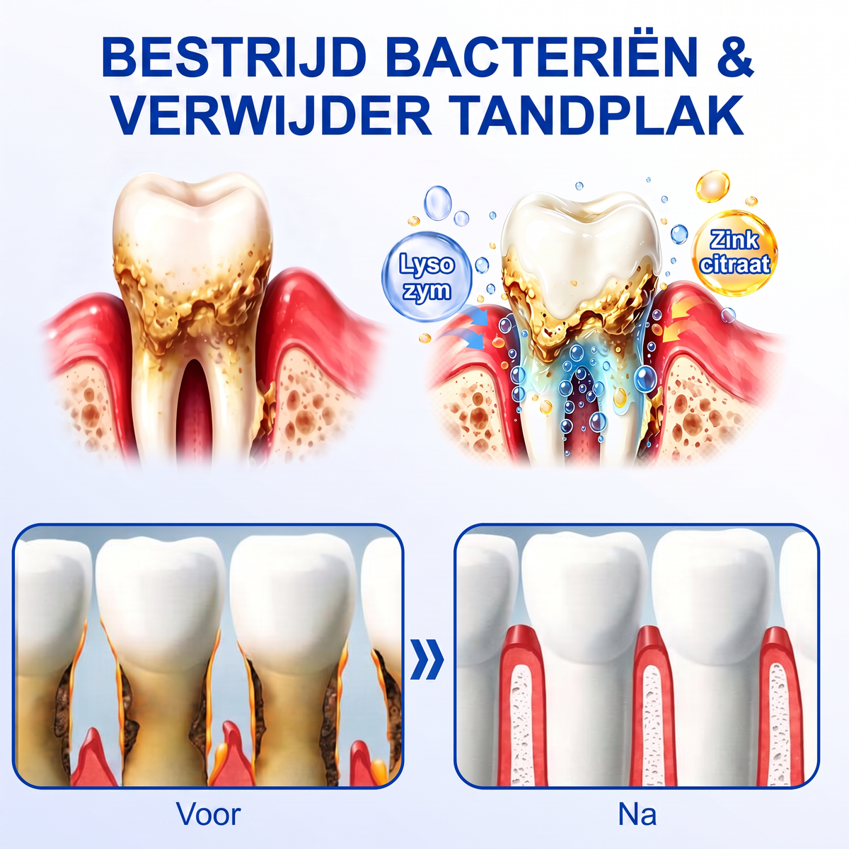 🏅🧸𝐺𝑙𝑖𝑚𝘮𝘦𝘳𝘭𝘺® 🦷 GUMREVIVE PERIODONTAAL REPARATIEGEL
